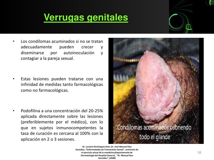 Emfermedades del sexo anal pics 311